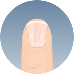 Healthy fingernail appearance and nail structure